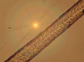 Wool fibers under a microscope.
